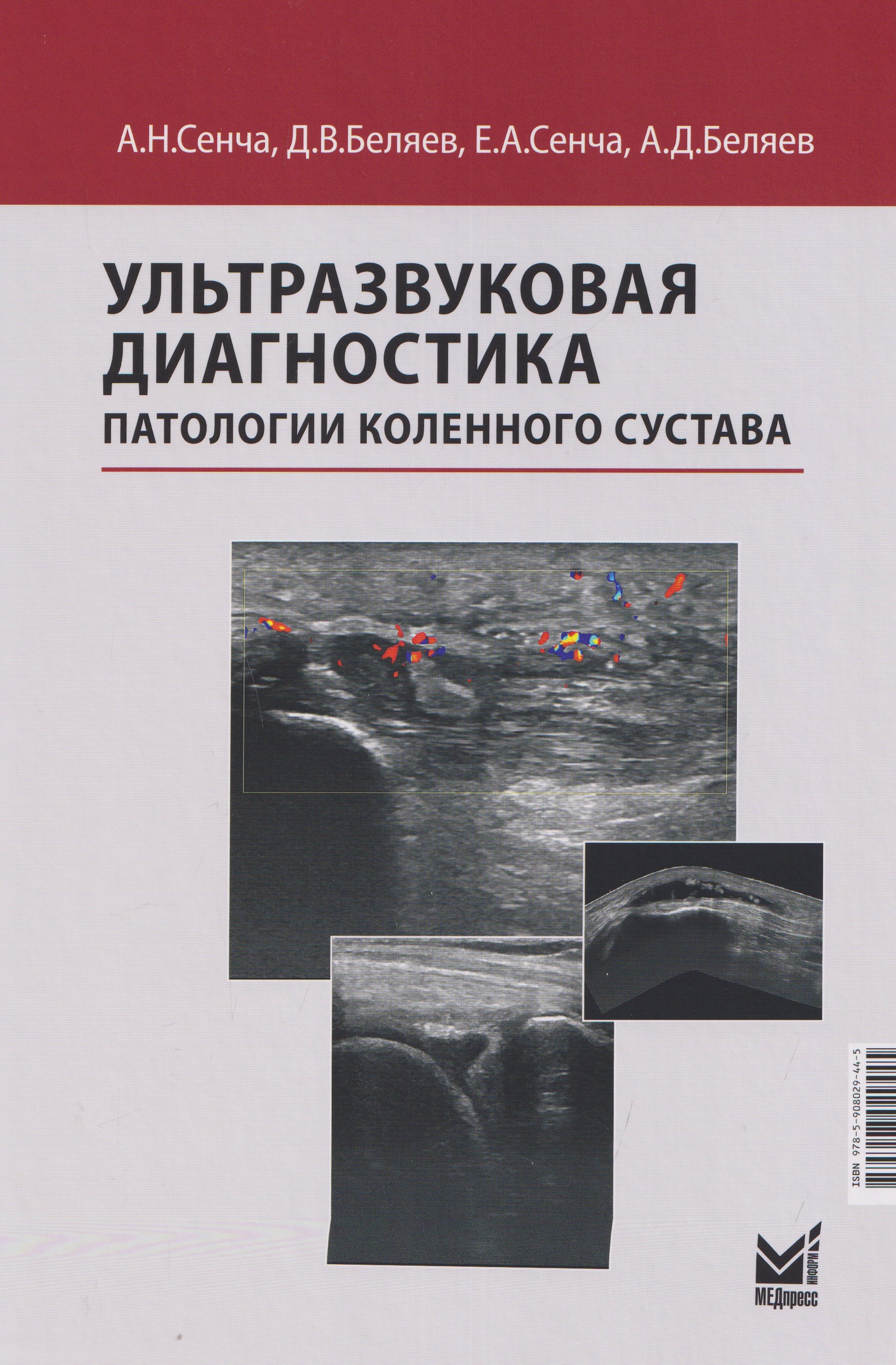 

Ультразвуковая диагностика патологии коленного сустава