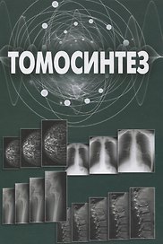Томосинтез