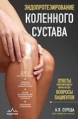 Эндопротезирование коленного сустава: ответы практикующего врача на все вопросы пациентов - 0