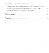 Туннельные пудендоневропати - 2