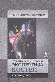 Судебно-медицинская экспертиза костей