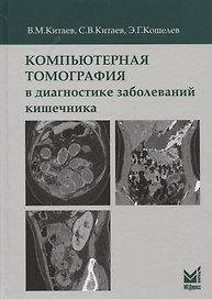 Компьютерная томография в диагностике заболеваний кишечника