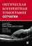 Оптическая когерентная томография сетчатки - 1