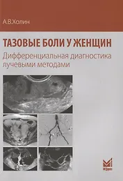 Тазовые боли у женщин Дифференциальная диагностика лучевыми методами (м) Холин