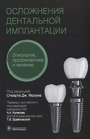 Осложнения дентальной имплантации. Этиология, профилактика и лечение