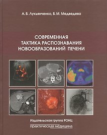 Современная тактика распознавания новообразований печени