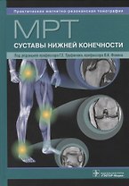 МРТ. Суставы нижней конечности