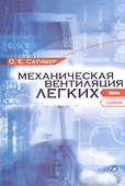 Механическая вентиляция легких - 0