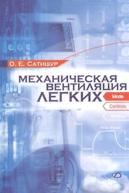 Механическая вентиляция легких