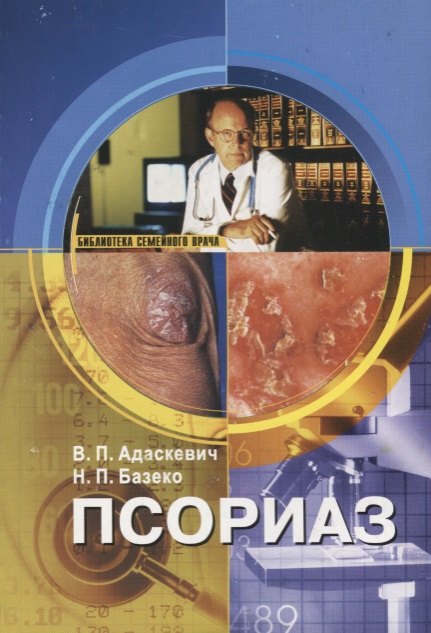 

Псориаз