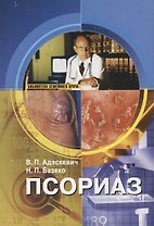 Псориаз