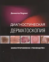 Диагностическая дерматоскопия Иллюстрированное руководство (м) Боулинг
