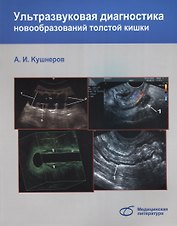Ультразвуковая диагностика новообразований толстой кишки