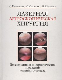 Лазерная артроскопическая хирургия. Дегенеративно-дистрофические поражения коленного сустава