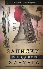 Записки городского хирурга