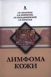 Лимфома кожи