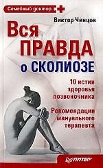Вся правда о сколиозе