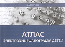 Атлас электроэнцефалограмм детей