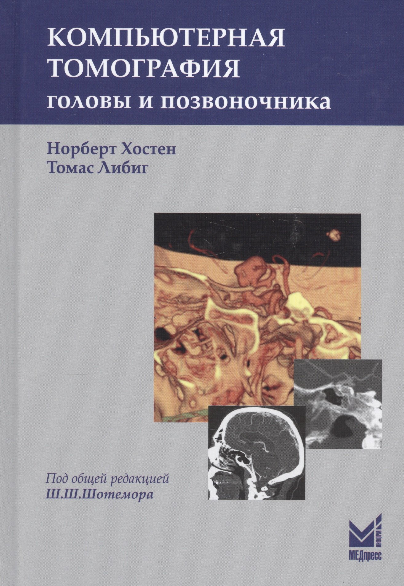 

Компьютерная томография головы и позвоночника