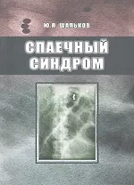 Спаечный синдром.