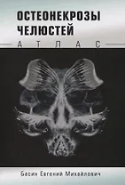 Остеонекрозы челюстей. Атлас