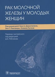 Рак молочной железы у молодых женщин