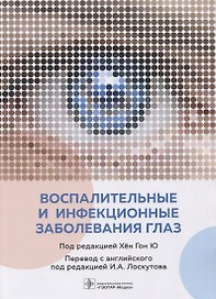 Воспалительные и инфекционные заболевания глаз