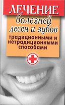 Лечение болезней десен и зубов традиционными и нетрадиционными способами / Исаева Е. (Рипол)