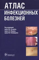Атлас инфекционных болезней