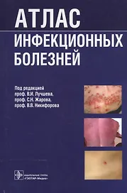 Атлас инфекционных болезней