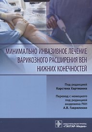 Минимально инвазивное лечение варикозного расширения вен нижних конечностей