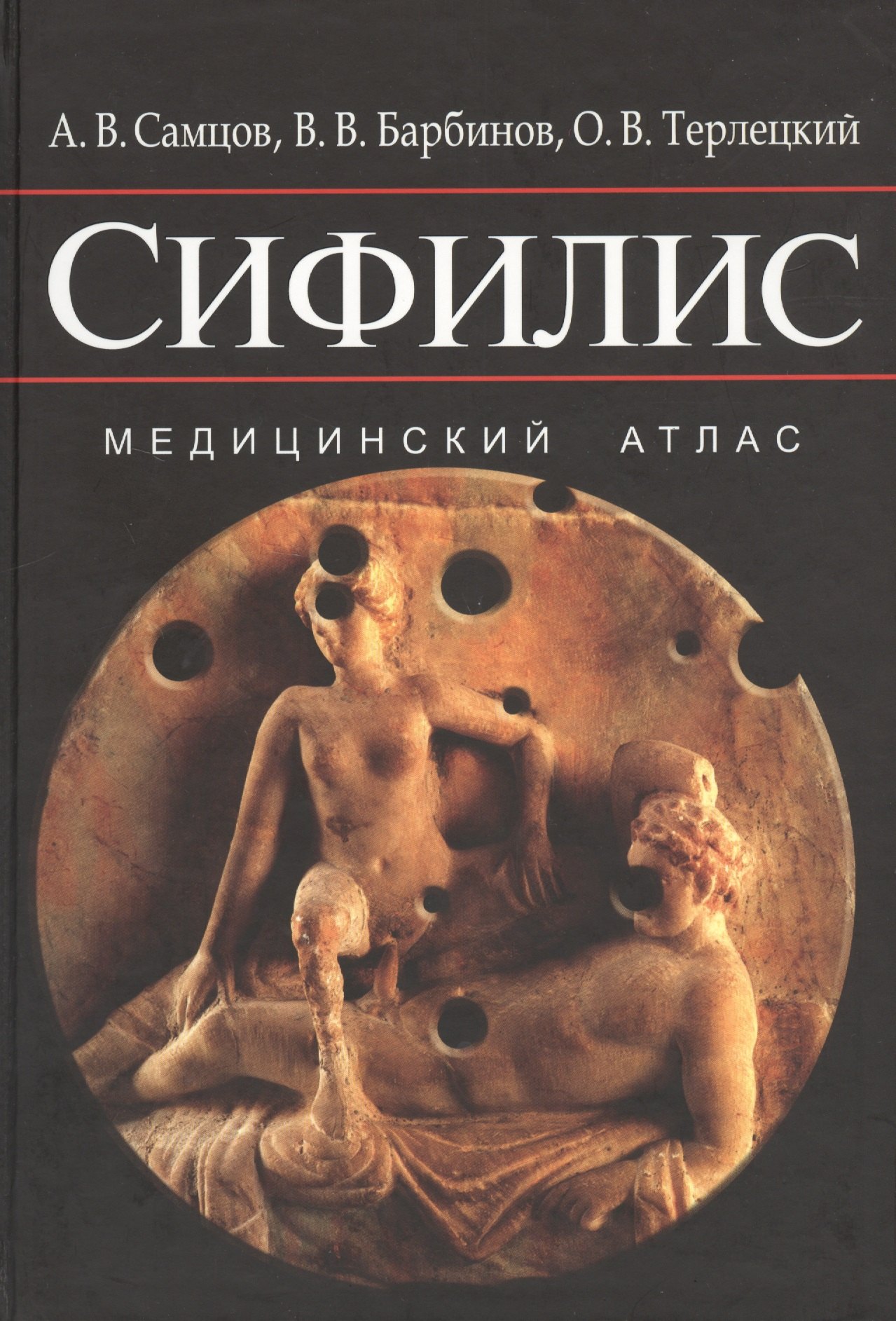 

Сифилис. Медицинский атлас