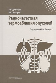 Радиочастотная термоаблация опухолей