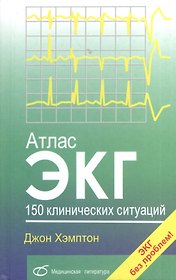 Атлас ЭКГ. 150 клинических ситуаций