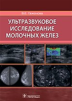 Ультразвуковое исследование молочных желез