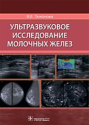 Ультразвуковое исследование молочных желез