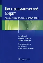 Посттравматический артрит. Диагностика, лечение и результаты