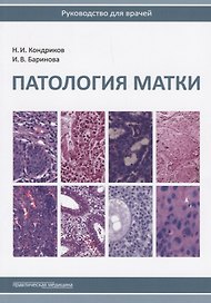 Патология матки Руководство для врачей (2 изд.) (м) Кондриков