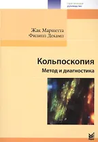 Кольпоскопия