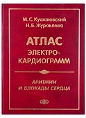 Атлас электрокардиограмм. Аритмии и блокады сердца - 0