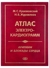 Атлас электрокардиограмм. Аритмии и блокады сердца