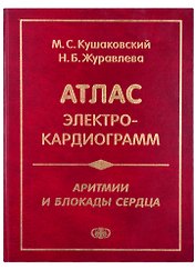 Атлас электрокардиограмм. Аритмии и блокады сердца
