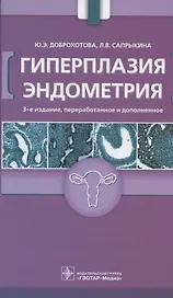 Гиперплазия эндометрия