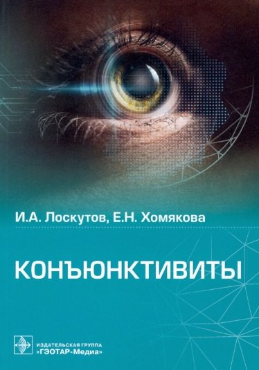 

Конъюнктивиты