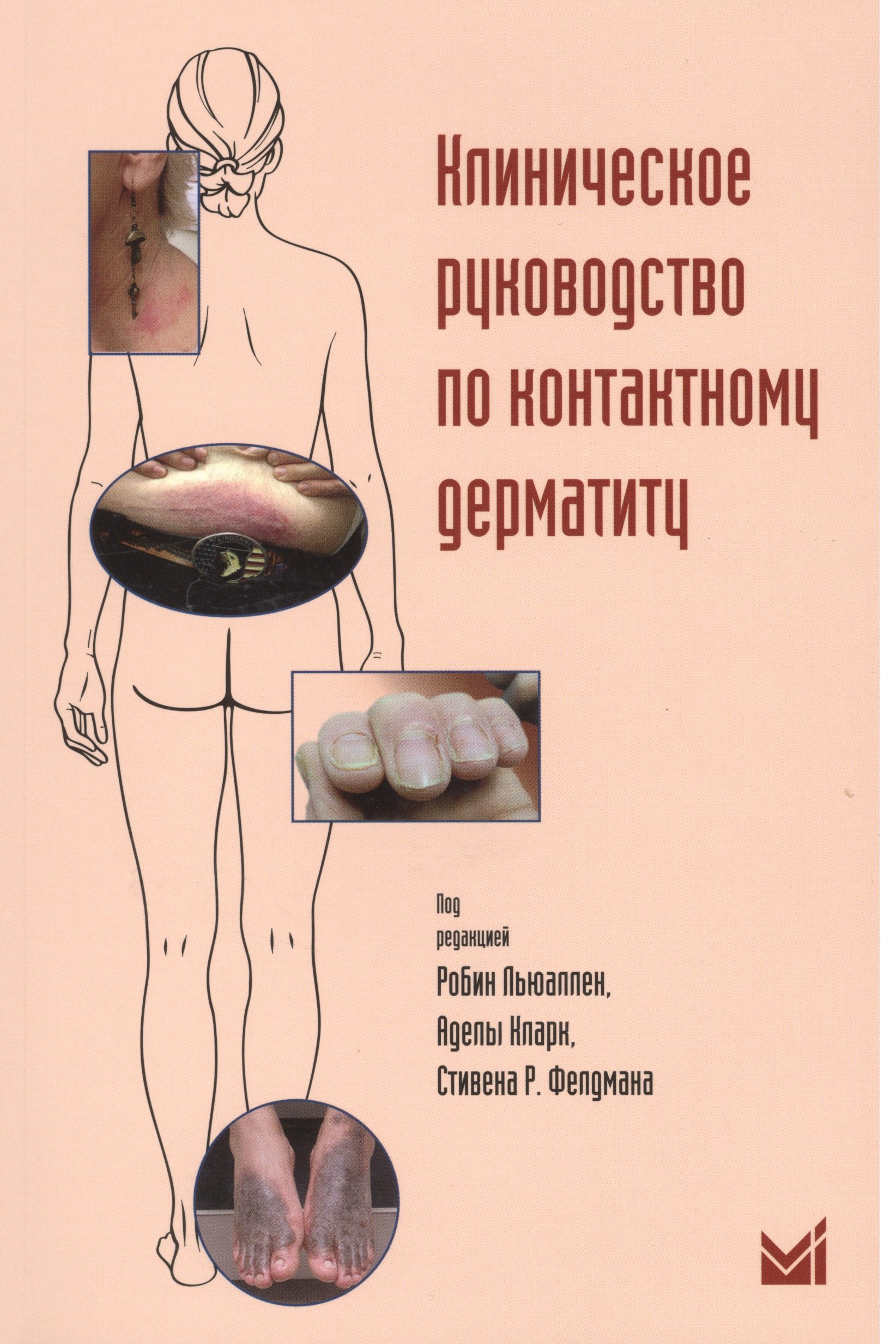 

Клиническое руководство по контактному дерматиту