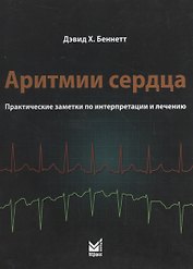 Аритмии сердца. Практические заметки по интерпретации и лече