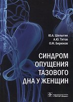 Синдром опущения тазового дна у женщин