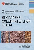 Дисплазия соединительной ткани