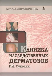 Клиника наследственных дерматозов. Атлас-справочник