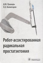 Робот-ассистированная радикальная простатэктомия